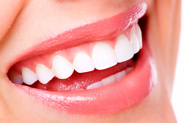 Image result for Dental implants image