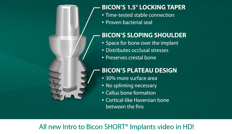 Introduction to Bicon SHORT® Implants [HD] Video